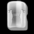Thumbnail for version as of 01:16, July 17, 2024