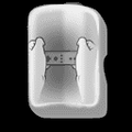 Thumbnail for version as of 01:16, July 17, 2024